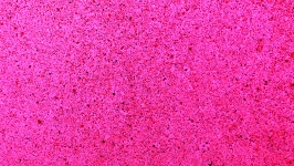 Pink Speckled Background
