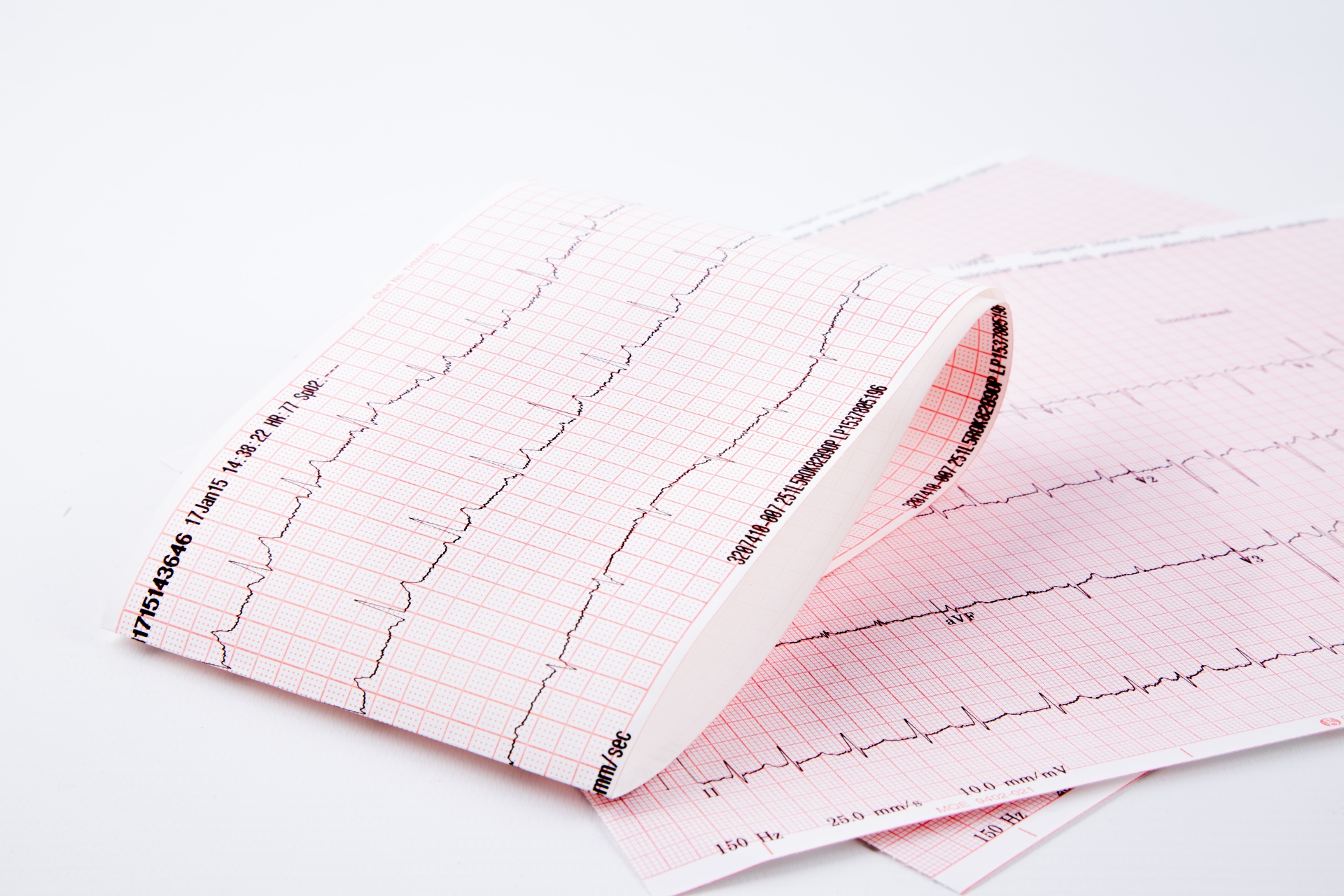 Cardiogram Pulse Trace