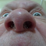 Hairy Nose