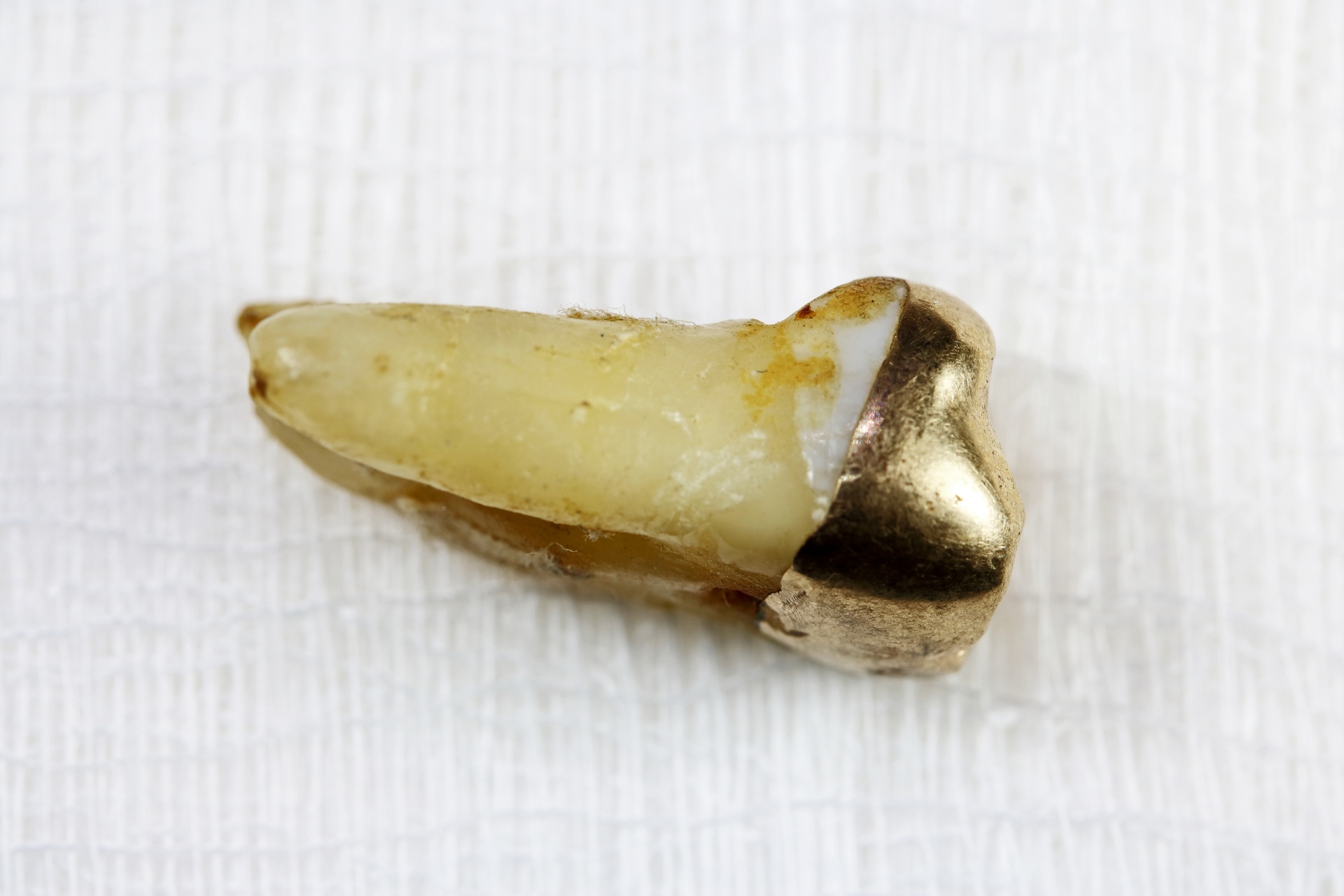 Pulled Molar With Caries And Gold