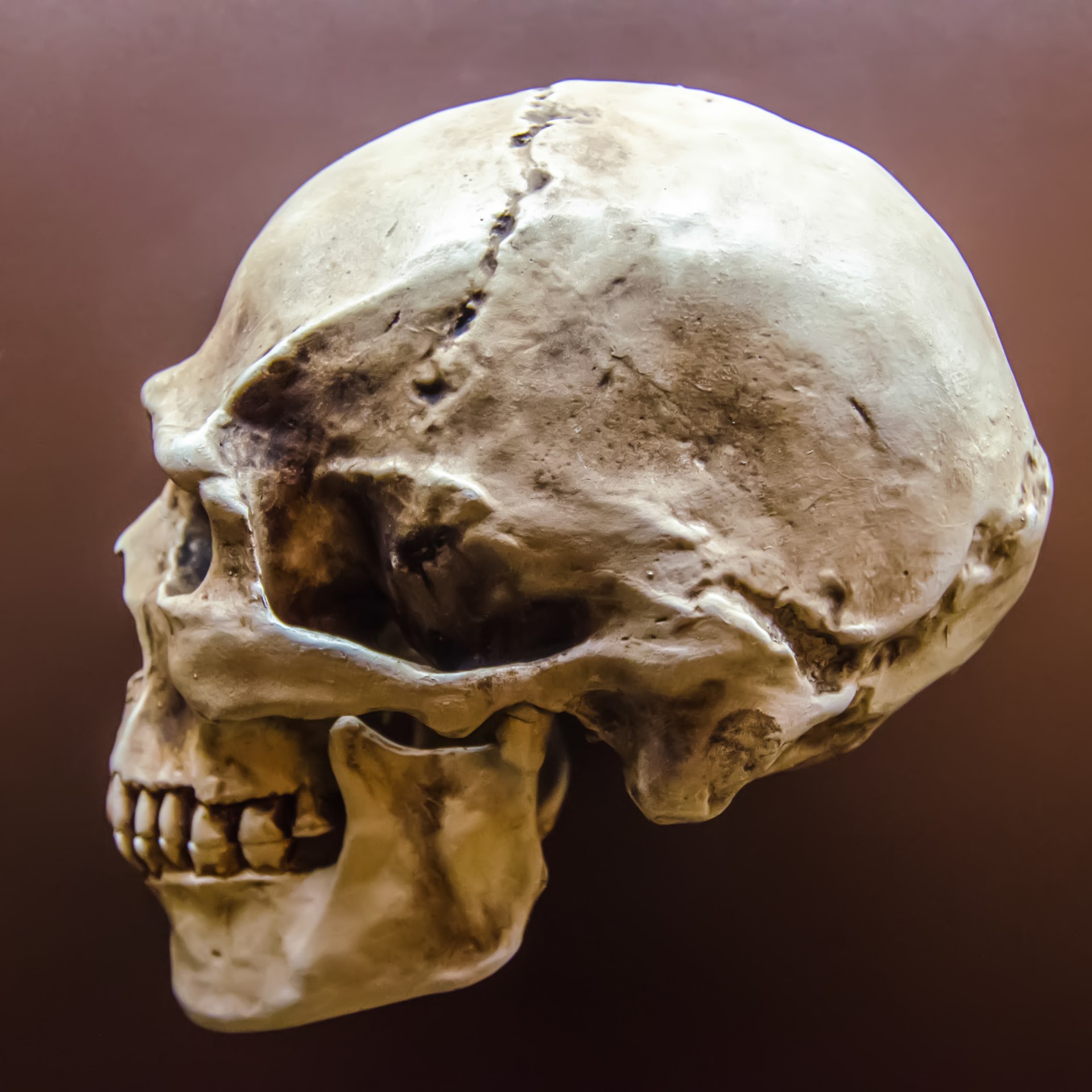 Human Skull On Display